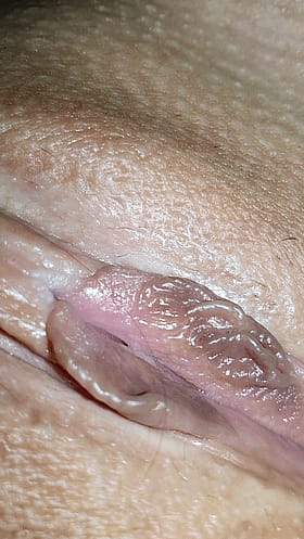 Worship That Sweet Pus'