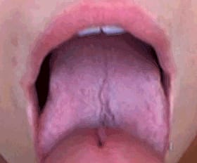 Throat Bulge Nut Buster'